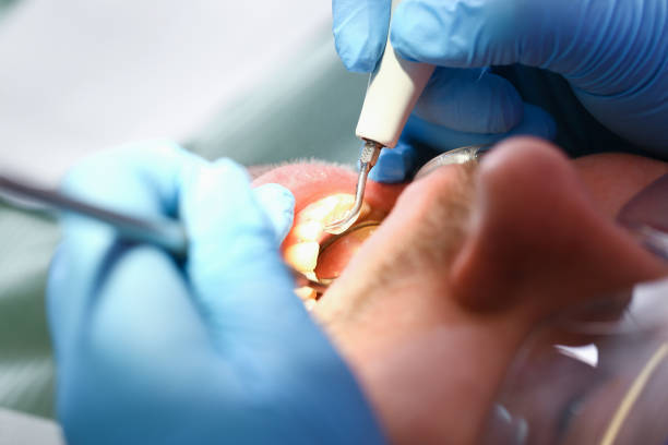 Best Emergency Care for Gum Disease in Glens Falls North, NY